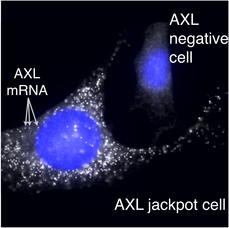 Shaffer cells