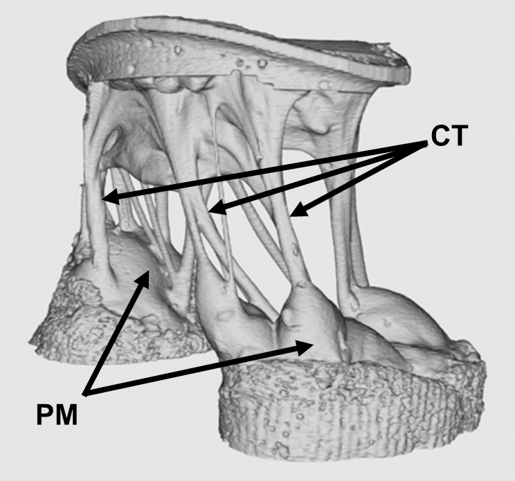 7T-MRI