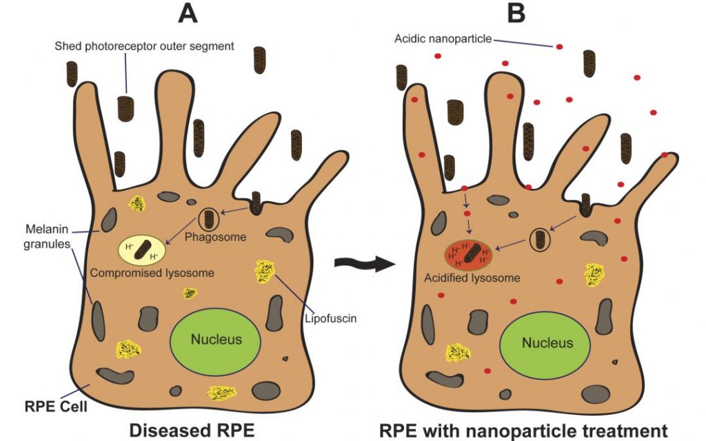 nanoparticle