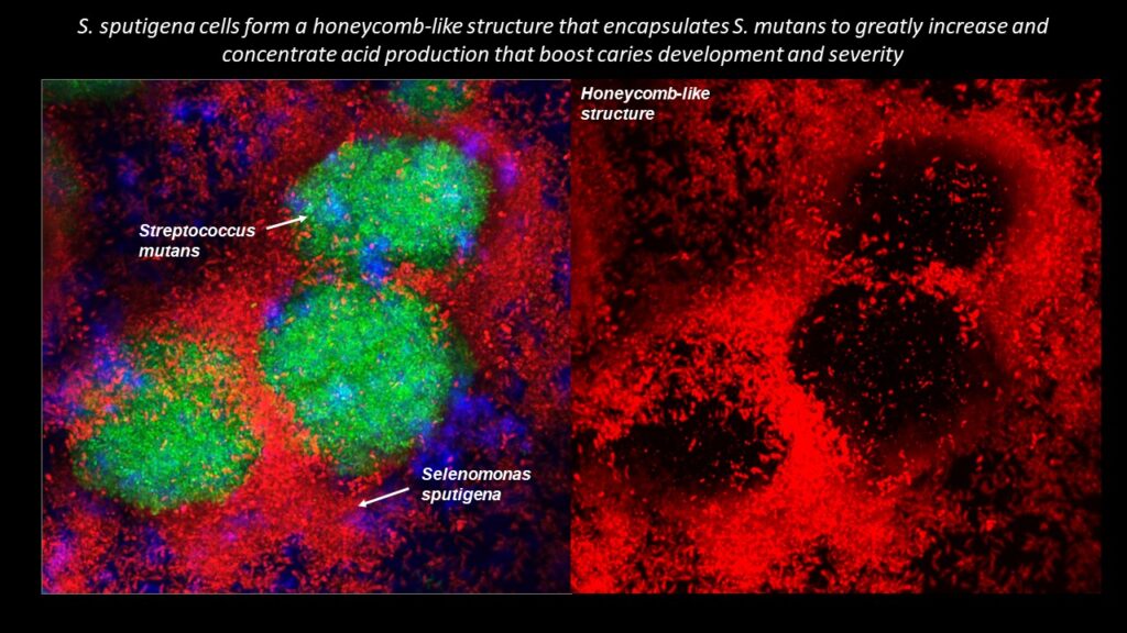 Penn Dental Medicine Collaboration Identifies New Bacterial Species ...