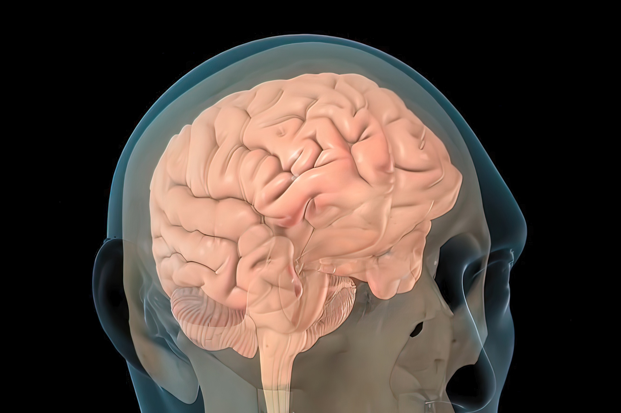 AI-guided Brain Stimulation Aids Memory in Traumatic Brain Injury